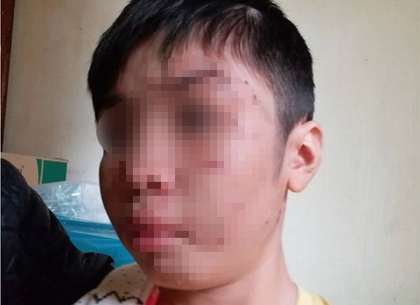 B&eacute; trai 10 tuổi bị bạo h&agrave;nh: Đến bữa ăn, bố v&agrave; c&ocirc; b&ecirc; m&acirc;m v&agrave;o trong ph&ograve;ng, c&ograve;n ch&aacute;u th&igrave; ăn ở ph&ograve;ng ngo&agrave;i - Ảnh 2.