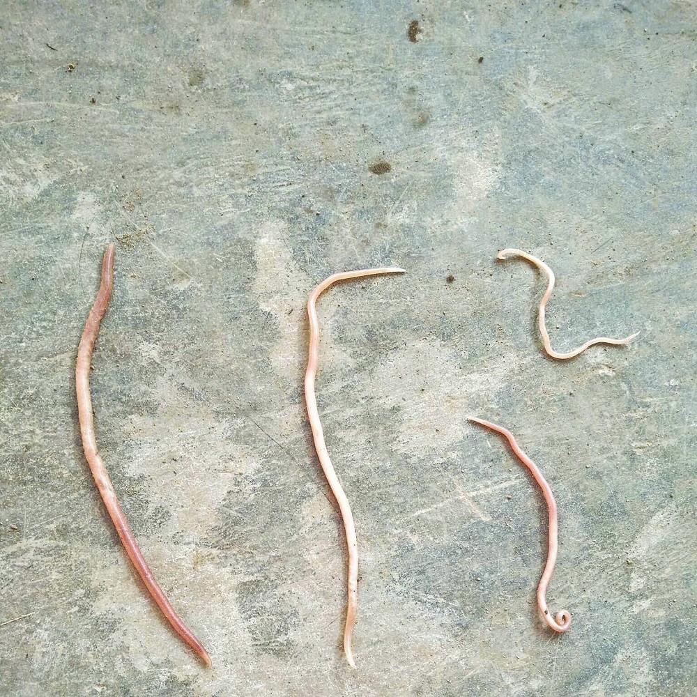 H&atilde;i h&ugrave;ng giun s&aacute;n d&agrave;i nửa m&eacute;t b&ograve; ra từ... miệng c&aacute;c em nhỏ - Ảnh 1.