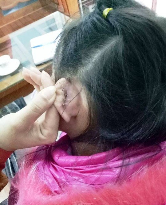 Học sinh bị rách tai khâu 4 mũi, hiệu trưởng nói nghe phong thanh - Ảnh 1.