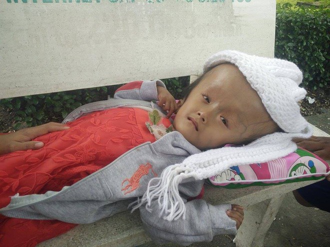 Gần 70 triệu đồng đã giúp bé gái 4 tuổi bị não úng thủy bẩm sinh phẫu thuật thành công, giữ lại mạng sống - Ảnh 2.