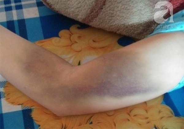 Người vợ trẻ bị bồ của chồng đánh ghen ngược: Nhìn con đòi mẹ mà bản thân bất lực không thể lại gần - Ảnh 3. Người vợ trẻ bị bồ của chồng đánh ghen ngược: Nhìn con đòi mẹ mà bản thân bất lực không thể lại gần - Ảnh 3.