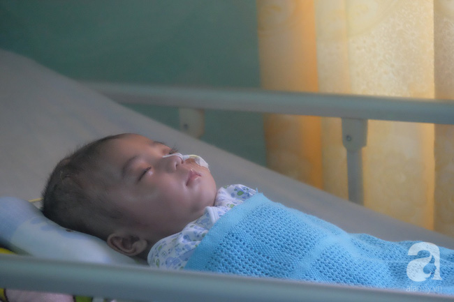 Em bé bị não úng thủy được đưa sang Singapore lần 2 để tiểu phẫu - Ảnh 3.