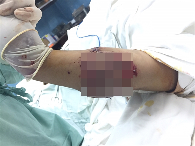 C&ocirc; g&aacute;i 21 tuổi hồi sinh c&aacute;nh tay kỳ diệu - Ảnh 3.