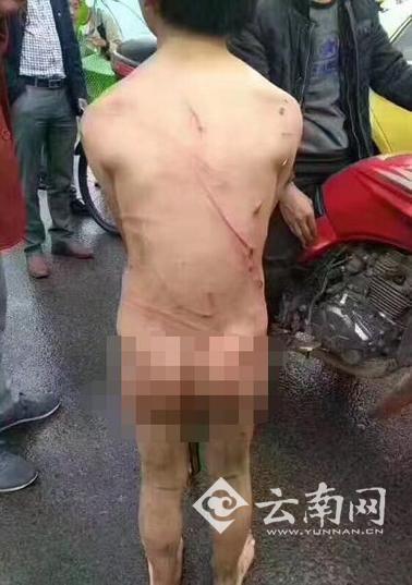 Bé trai bị bố đánh đập, bắt cởi quần áo chạy theo xe máy dưới mưa - Ảnh 3.