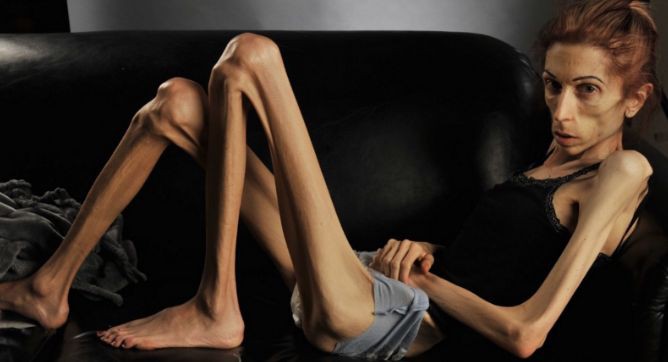 Từ cơ thể 18kg chỉ c&oacute; da bọc xương, người phụ nữ lột x&aacute;c th&agrave;nh thi&ecirc;n nga xinh đẹp khiến ai cũng ngỡ ng&agrave;ng - Ảnh 3.