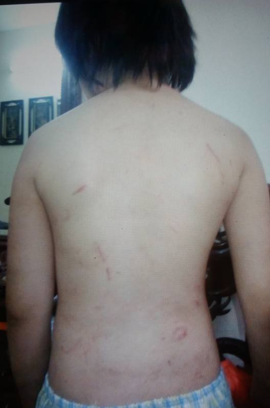 H&agrave; Nội: B&eacute; trai 10 tuổi th&aacute;o chạy khỏi bố v&agrave; mẹ kế, t&igrave;m về &ocirc;ng b&agrave; nội v&igrave; bị bạo h&agrave;nh? - Ảnh 3.