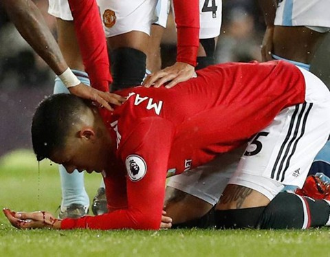 CẬN CẢNH: Rợn người với chấn thương ở đầu Marcos Rojo, phải dùng kẹp ghim để vá lại - Ảnh 3.