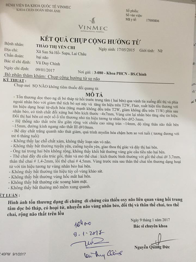 Mẹ nuôi của em bé Lào Cai suy dinh dưỡng lên mạng cầu cứu giúp đỡ vì phát hiện bé tổn thương não - Ảnh 4.