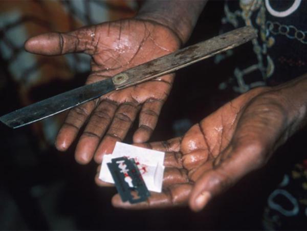 Lời giải khoa học cho hủ tục cắt bỏ âm vật của bé gái ở châu Phi  - Ảnh 5.