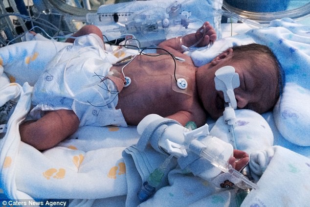 Thai phụ vỡ tử cung, đứa trẻ suýt “chết đuối” trong bụng mẹ vì một biến chứng nguy hiểm - Ảnh 5.