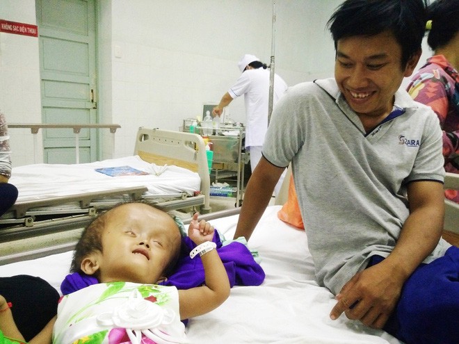 Xót cảnh bé gái 4 tuổi bị não úng thủy, đầu to gấp ba lần người thường mà bố mẹ nghèo không tiền chạy chữa - Ảnh 5.