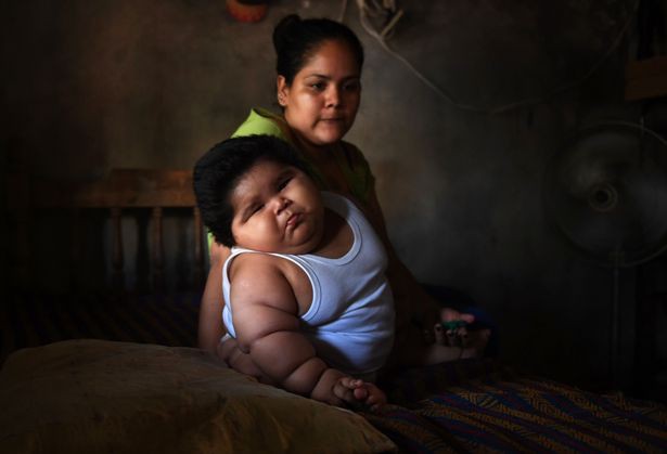 Con 10 tháng nặng 28kg, mẹ đinh ninh con hấp thu sữa mẹ tốt mà không ngờ có thể mắc bệnh đặc biệt - Ảnh 6.