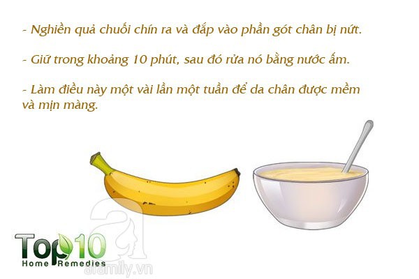 7 mẹo hàng đầu giúp bạn không bị nhiễm trùng và nứt gót chân trong mùa đông này - Ảnh 6.