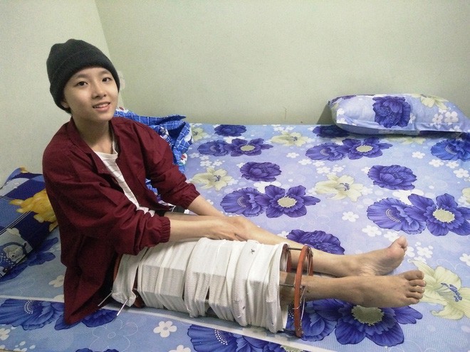 Mẹ vừa mới mất, người cha đau đớn nh&igrave;n con g&aacute;i 15 tuổi mắc bệnh ung thư xương &aacute;c t&iacute;nh m&agrave; kh&ocirc;ng tiền chữa trị - Ảnh 6.