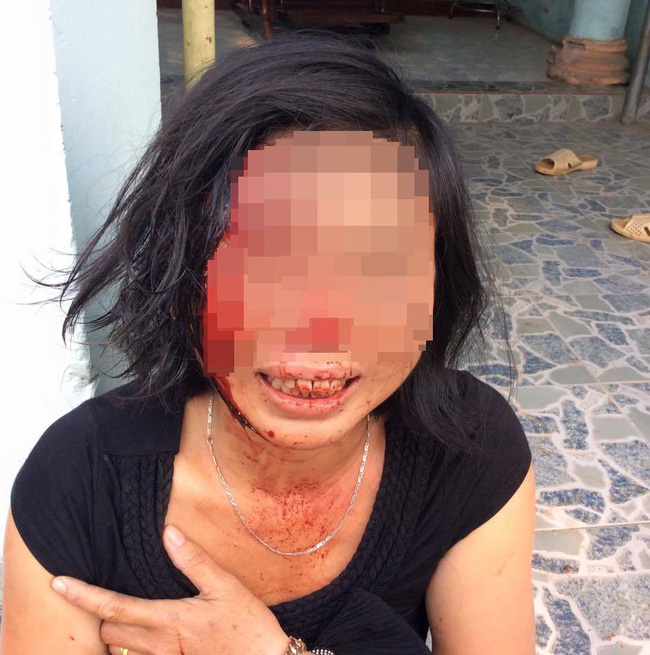 Con trai người phụ nữ bị chồng bạo hành tại Đồng Nai: “Mẹ bị cha dượng đánh suốt 23 năm nay - Ảnh 7.