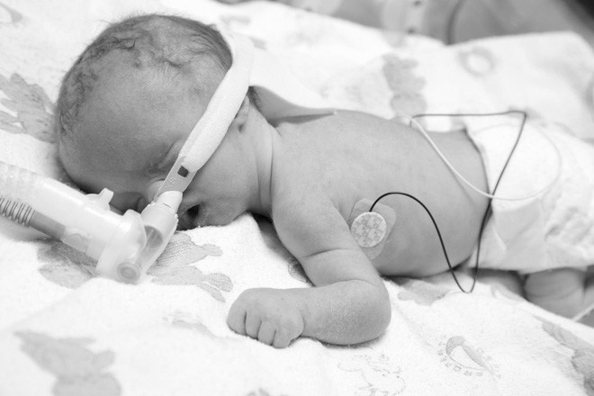 C&acirc;u chuyện x&uacute;c động của b&eacute; g&aacute;i chỉ sống hơn 2 ng&agrave;y sau khi ch&agrave;o đời v&igrave; hội chứng nguy hiểm trong thai k&igrave; - Ảnh 7.