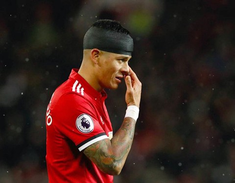 CẬN CẢNH: Rợn người với chấn thương ở đầu Marcos Rojo, phải dùng kẹp ghim để vá lại - Ảnh 7.