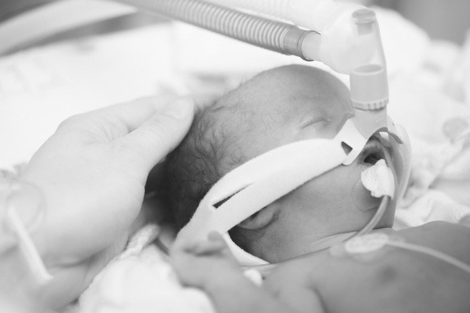 C&acirc;u chuyện x&uacute;c động của b&eacute; g&aacute;i chỉ sống hơn 2 ng&agrave;y sau khi ch&agrave;o đời v&igrave; hội chứng nguy hiểm trong thai k&igrave; - Ảnh 8.