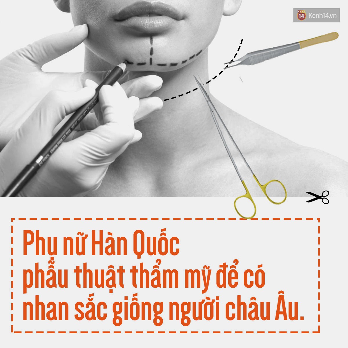 Cơn sốt phẫu thuật thẩm mỹ tại Hàn Quốc: Nguồn cơn nào khiến chị em không thể cưỡng lại vòng xoáy “đập đi xây lại”? - Ảnh 9.