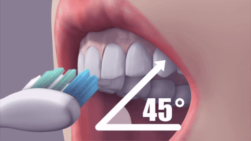 Hậu quả kinh hoàng cho răng vì thói quen đánh răng mà ai cũng mắc phải - Ảnh 4.