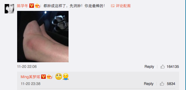 Sự thật gây sốc về bức ảnh cổ chân sưng to của Ming Xi sau cú ngã sấp mặt tại Victorias Secret bị bóc mẽ - Ảnh 4.