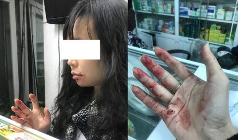 Công an vào cuộc điều tra hàng loạt tin nhắn đe dọa nữ hành khách bị tài xế Uber đánh bầm mặt - Ảnh 1. Công an vào cuộc điều tra hàng loạt tin nhắn đe dọa nữ hành khách bị tài xế Uber đánh bầm mặt - Ảnh 1.