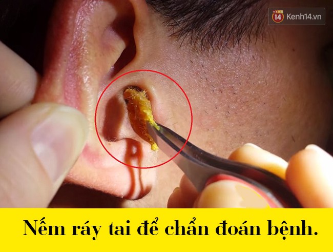 Biết người Hy Lạp cổ sống qu&aacute;i dị thế n&agrave;y, bạn sẽ thầm cảm ơn v&igrave; đang sống ở thế kỷ 21 - Ảnh 1.