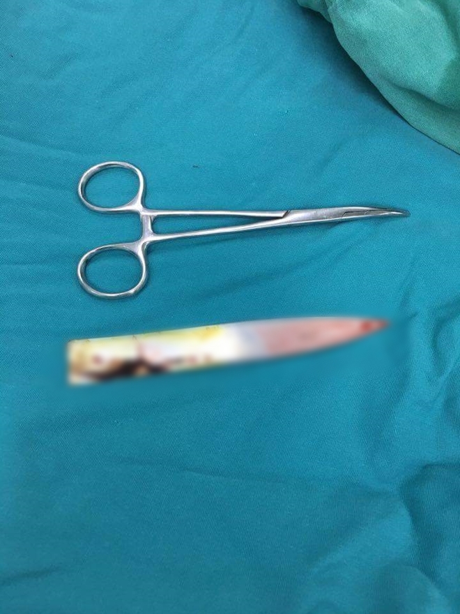 Đưa bạn g&aacute;i về, nam thanh ni&ecirc;n bị 4 kẻ lạ mặt d&ugrave;ng dao đ&acirc;m thấu lưng - Ảnh 2.