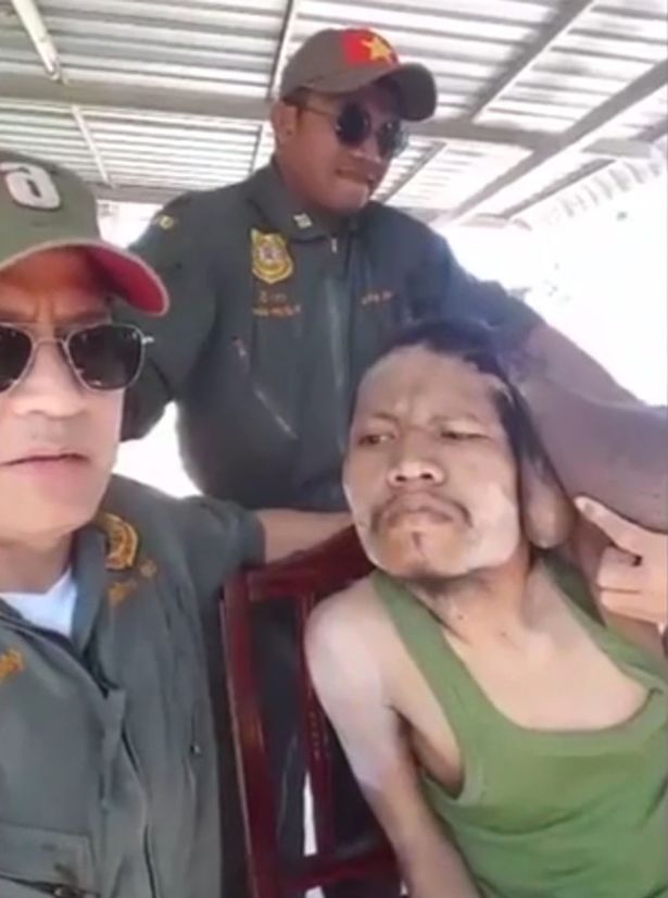 Sau tất cả, ph&eacute;p m&agrave;u đ&atilde; đến với người đ&agrave;n &ocirc;ng c&oacute; khối u khổng lồ tr&ecirc;n đầu - Ảnh 2.