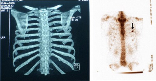 Cắt bỏ xương sườn - có đáng đánh đổi để sở hữu vòng eo 56 đầy đau đớn? - Ảnh 4.