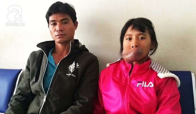 X&oacute;t l&ograve;ng thiếu nữ 15 tuổi mang &ldquo;ng&oacute;n tay&rdquo; tr&ecirc;n miệng, bỏ học v&igrave; bạn b&egrave; tr&ecirc;u chọc - Ảnh 4.