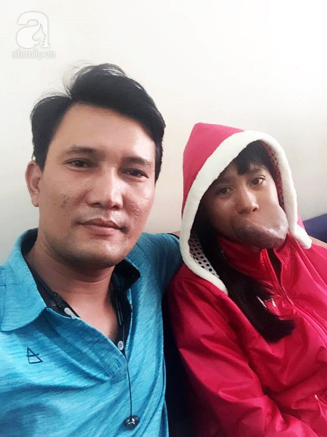 X&oacute;t l&ograve;ng thiếu nữ 15 tuổi mang &ldquo;ng&oacute;n tay&rdquo; tr&ecirc;n miệng, bỏ học v&igrave; bạn b&egrave; tr&ecirc;u chọc - Ảnh 5.