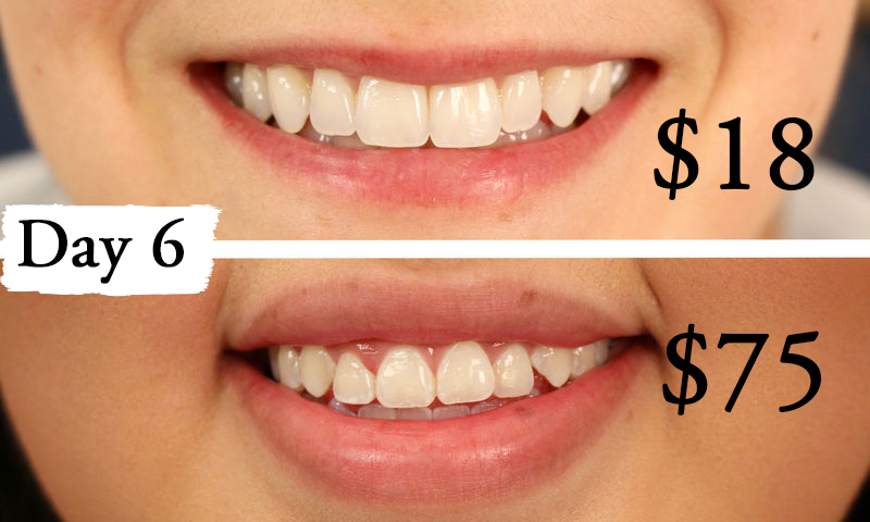 Thử làm trắng răng với 2 sản phẩm đắt và rẻ tiền, 2 cô nàng này đã nhận được kết quả ngoài dự kiến - Ảnh 8.