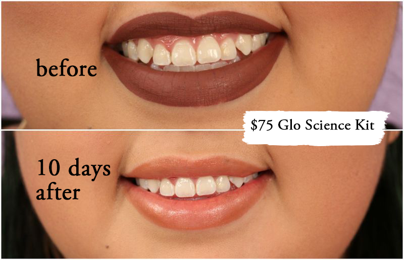 Thử làm trắng răng với 2 sản phẩm đắt và rẻ tiền, 2 cô nàng này đã nhận được kết quả ngoài dự kiến - Ảnh 10.