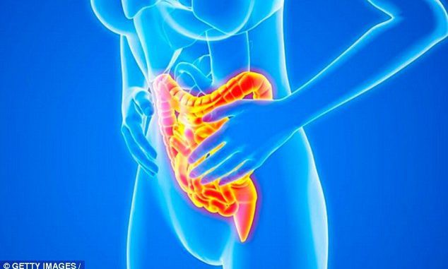 Những biện pháp điều trị bệnh Crohn - bệnh viêm ruột đơn giản mà hiệu quả tại nhà - Ảnh 1.