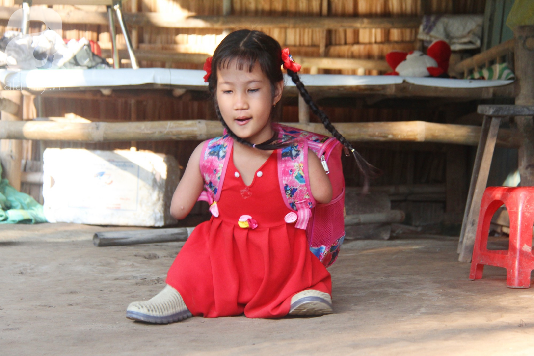 Bố mất, mẹ bỏ đi lấy chồng, bé gái 8 tuổi ngây ngô hỏi: Ngoại ơi, sao mẹ sinh con ra cụt tay cụt chân vậy ạ - Ảnh 11. Bố mất, mẹ bỏ đi lấy chồng, bé gái 8 tuổi ngây ngô hỏi: Ngoại ơi, sao mẹ sinh con ra cụt tay cụt chân vậy ạ - Ảnh 11.