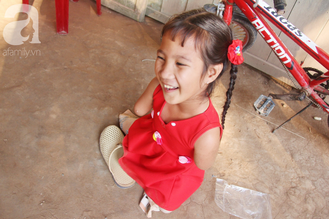 Bố mất, mẹ bỏ đi lấy chồng, bé gái 8 tuổi ngây ngô hỏi: Ngoại ơi, sao mẹ sinh con ra cụt tay cụt chân vậy ạ - Ảnh 20. Bố mất, mẹ bỏ đi lấy chồng, bé gái 8 tuổi ngây ngô hỏi: Ngoại ơi, sao mẹ sinh con ra cụt tay cụt chân vậy ạ - Ảnh 20.