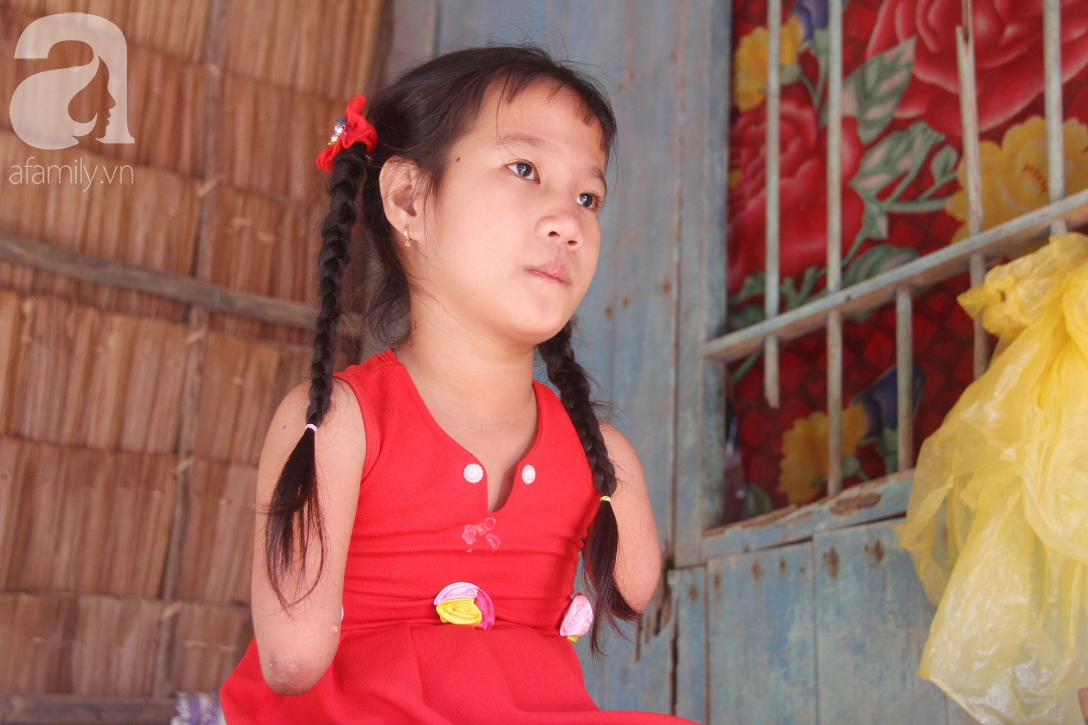 Bố mất, mẹ bỏ đi lấy chồng, bé gái 8 tuổi ngây ngô hỏi: Ngoại ơi, sao mẹ sinh con ra cụt tay cụt chân vậy ạ - Ảnh 5. Bố mất, mẹ bỏ đi lấy chồng, bé gái 8 tuổi ngây ngô hỏi: Ngoại ơi, sao mẹ sinh con ra cụt tay cụt chân vậy ạ - Ảnh 5.