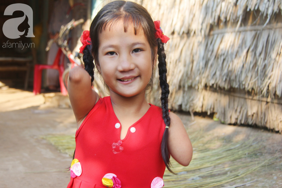 Bố mất, mẹ bỏ đi lấy chồng, bé gái 8 tuổi ngây ngô hỏi: Ngoại ơi, sao mẹ sinh con ra cụt tay cụt chân vậy ạ - Ảnh 9. Bố mất, mẹ bỏ đi lấy chồng, bé gái 8 tuổi ngây ngô hỏi: Ngoại ơi, sao mẹ sinh con ra cụt tay cụt chân vậy ạ - Ảnh 9.