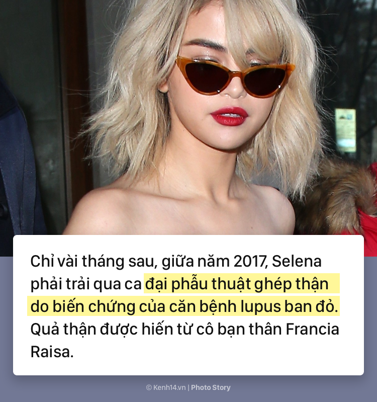 Selena Gomez v&agrave; h&agrave;nh tr&igrave;nh 5 năm chống chọi với căn bệnh lupus ban đỏ k&egrave;m di chứng - Ảnh 7.