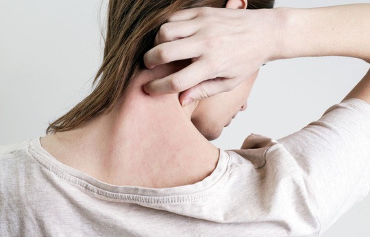 5 triệu chứng tưởng v&ocirc; hại lại l&agrave; dấu hiệu bệnh nguy hiểm - Ảnh 1.