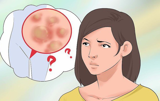 V&ugrave;ng k&iacute;n của con g&aacute;i đang c&oacute; vấn đề nghi&ecirc;m trọng nếu gặp phải một trong c&aacute;c dấu hiệu sau - Ảnh 1.