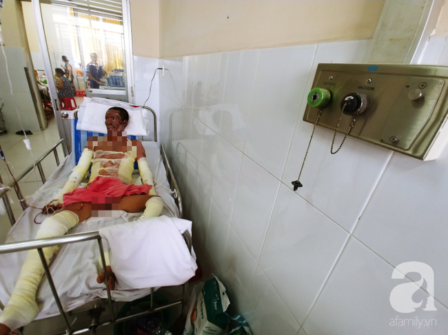 Người phụ nữ mất em trai, nuôi chồng nguy kịch vì cháy nhà: “Nếu có phép màu, em chỉ mong được đổi mạng cho chồng” - Ảnh 9. Người phụ nữ mất em trai, nuôi chồng nguy kịch vì cháy nhà: “Nếu có phép màu, em chỉ mong được đổi mạng cho chồng” - Ảnh 9.