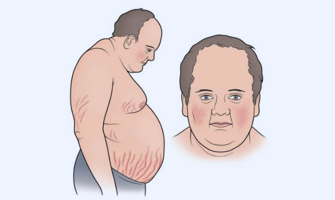 Giảm cân mãi không thành có thể là do bạn đã mắc phải một số căn bệnh tiềm ẩn sau - Ảnh 6. Giảm cân mãi không thành có thể là do bạn đã mắc phải một số căn bệnh tiềm ẩn sau - Ảnh 6.