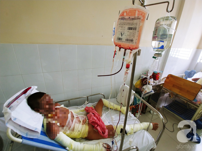 Người phụ nữ mất em trai, nuôi chồng nguy kịch vì cháy nhà: “Nếu có phép màu, em chỉ mong được đổi mạng cho chồng” - Ảnh 1. Người phụ nữ mất em trai, nuôi chồng nguy kịch vì cháy nhà: “Nếu có phép màu, em chỉ mong được đổi mạng cho chồng” - Ảnh 1.
