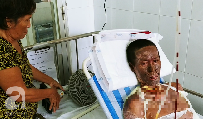 Người phụ nữ mất em trai, nuôi chồng nguy kịch vì cháy nhà: “Nếu có phép màu, em chỉ mong được đổi mạng cho chồng” - Ảnh 6. Người phụ nữ mất em trai, nuôi chồng nguy kịch vì cháy nhà: “Nếu có phép màu, em chỉ mong được đổi mạng cho chồng” - Ảnh 6.