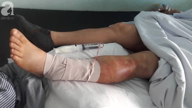 Hải Phòng: Người đàn ông kiệt quệ sau khi bị bạn gái thuê 5 côn đồ truy sát - Ảnh 2. Hải Phòng: Người đàn ông kiệt quệ sau khi bị bạn gái thuê 5 côn đồ truy sát - Ảnh 2.