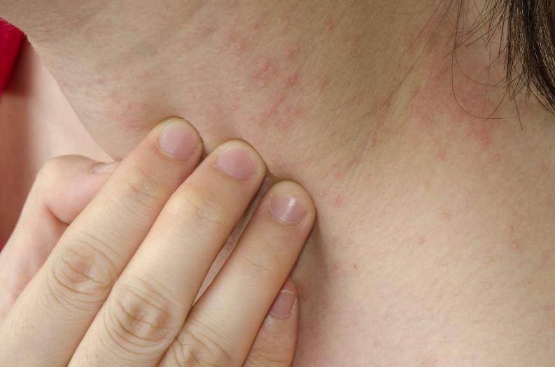 Cơ thể đột nhiên sưng tấy, phù nề có thể là do 6 nguyên nhân tiềm ẩn sau đây - Ảnh 2. Cơ thể đột nhiên sưng tấy, phù nề có thể là do 6 nguyên nhân tiềm ẩn sau đây - Ảnh 2.