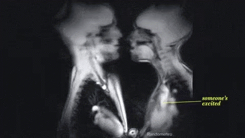 Những sự thật kinh ngạc mà bạn chỉ có thể nhìn thấy dưới ống kính X-quang - Ảnh 5.