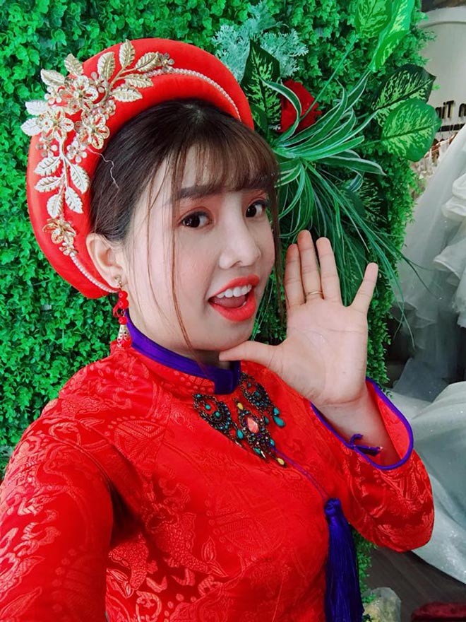 Phượng &ldquo;Thị Nở&rdquo; bất ngờ bị ng&atilde; trầy xước mặt mũi sau gần 2 năm thẩm mỹ khiến nhiều người lo lắng - Ảnh 2.